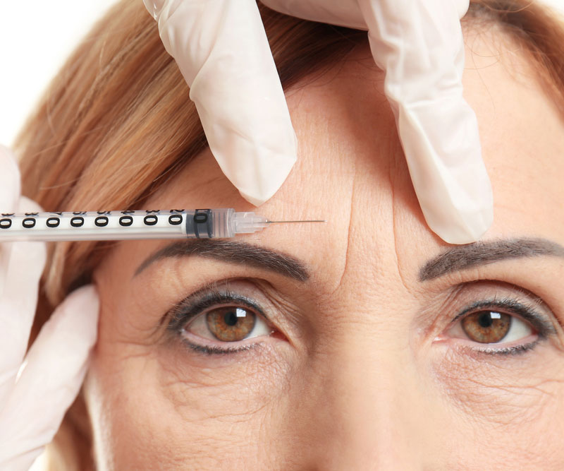 Wrinkle Reducing Injections