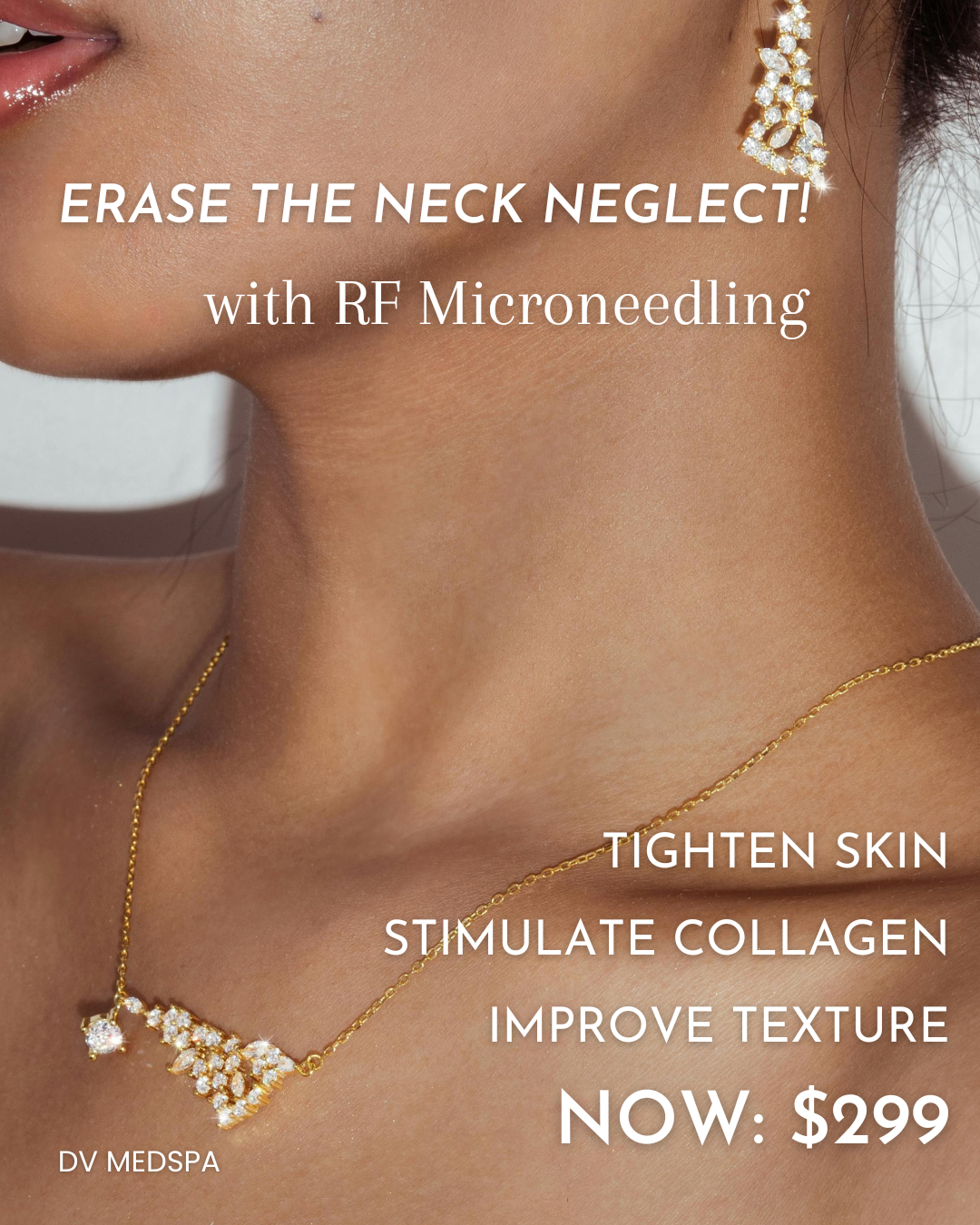 RF Microneedling